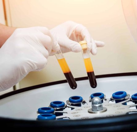 prp-centrifuge
